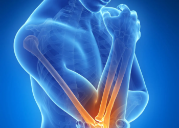 7 Proven Ways to Relieve Tennis Elbow Without Medication