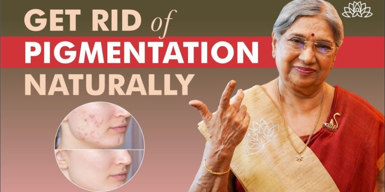 pigmentation cure