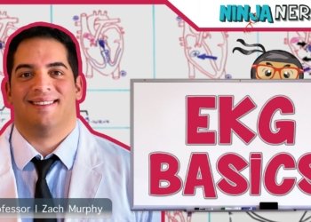 ECG basics