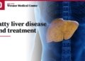 fatty liver treatment