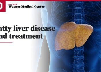 fatty liver treatment