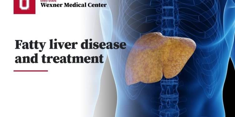 fatty liver treatment