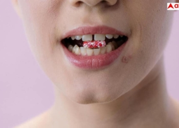 5 Warning Signs of Lip Cancer You Should Never Ignore See a Doctor Immediately Lip Cancer: होंठों पर नजर आते हैं इस कैंसर के 5 लक्षण, दिखते ही भागें डॉक्टर के पास