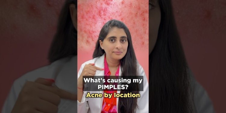 pimples cure