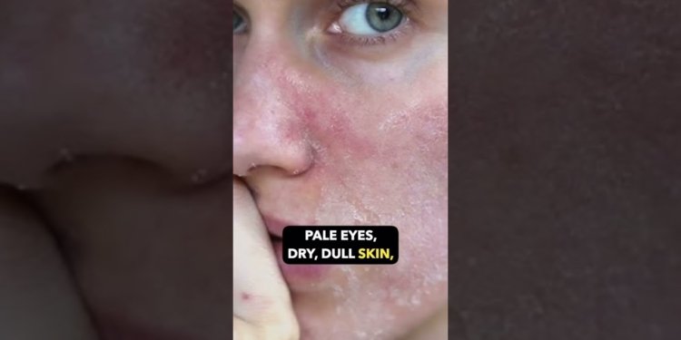 B12 deficiency treatment