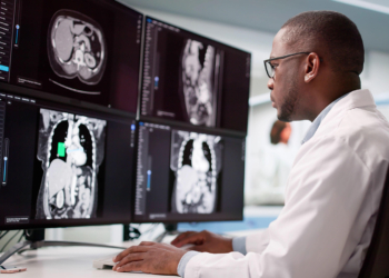 AI Beats Radiologists in Detecting Pancreatic Cancer on Routine CT Scans