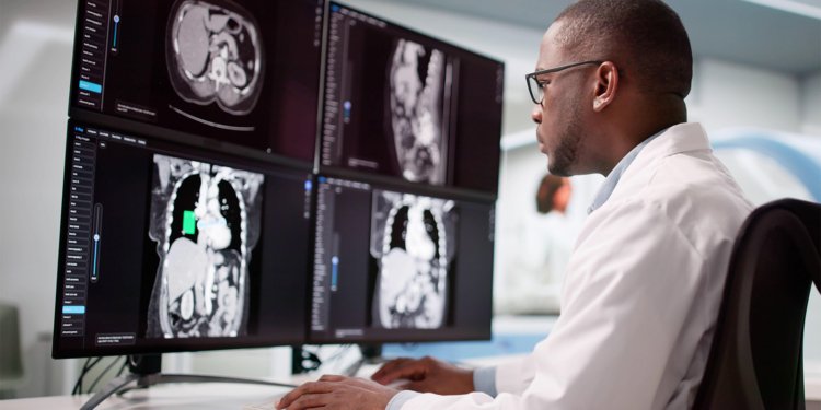 AI Beats Radiologists in Detecting Pancreatic Cancer on Routine CT Scans