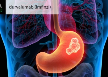 FDA OKs Perioperative Immunotherapy for Stomach Cancer