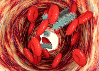 Adding Precision Immunotherapy Improved Sepsis Outcomes