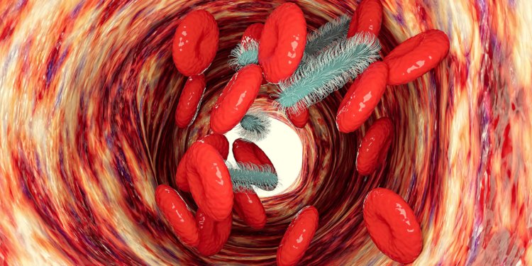 Adding Precision Immunotherapy Improved Sepsis Outcomes