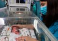 Survival Is Possible With Resuscitation in Some Infants Born Alive at 21 Weeks