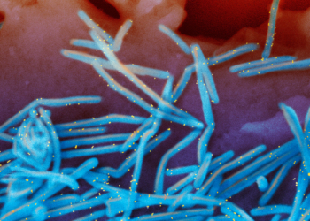 Winter Virus Season Not Too Bad So Far, but Docs Worry About Suffering to Come