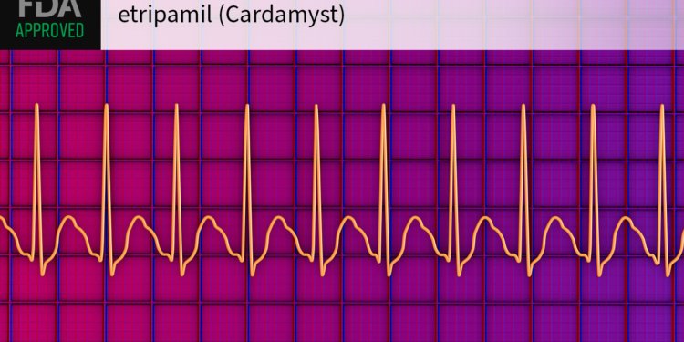 Etripamil Gets FDA Approval for At-Home Tachycardia Conversion
