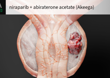 Akeega Approved for BRCA2-Mutated Prostate Cancer