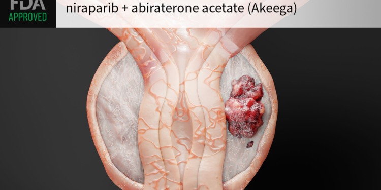 Akeega Approved for BRCA2-Mutated Prostate Cancer