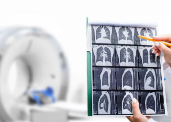 Lung Cancer Screening Follow-Up Often Inadequate