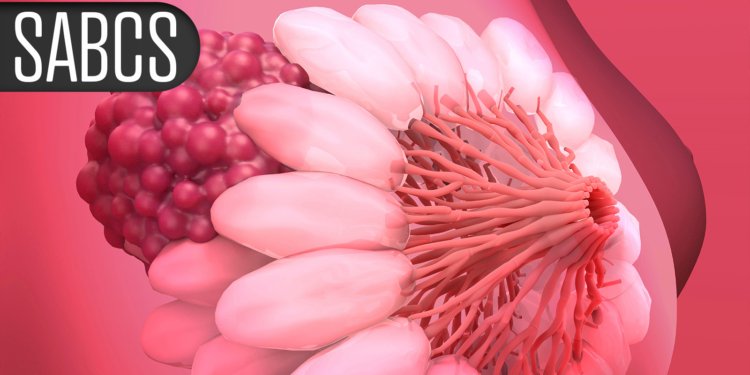 Bispecific Antibody Induces High Response Rate in Metastatic TNBC