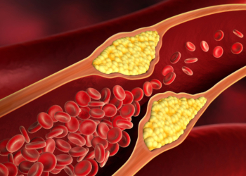 Tirzepatide Matches Competitor’s Cardioprotective Benefits for Diabetics