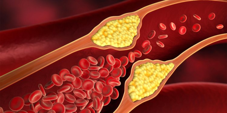 Tirzepatide Matches Competitor’s Cardioprotective Benefits for Diabetics