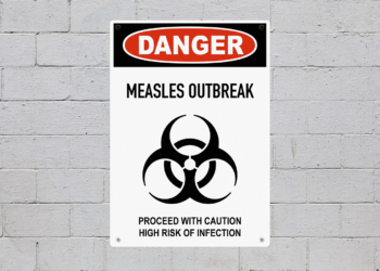 Here’s Where Measles Case Counts Are Highest