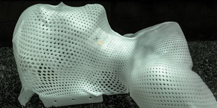 Proton Therapy for Oropharyngeal Cancer Makes a Case for Standard of Care