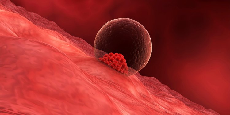 Twins Joined at the Heart: Single Embryo Transfer Results in Unusual Case