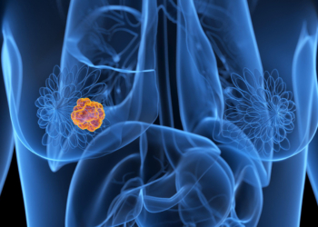 Overcoming CDK4/6 Inhibitor Resistance in HR-Positive/HER2-Negative Breast Cancer
