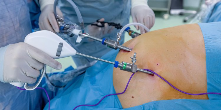 Incretin Therapies After Bariatric Surgery Linked to Lower Risk of Alcohol Disorder