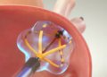 Pulsed Field Ablation Safety Issues: Will Newer Devices Clear the Stumbling Block?