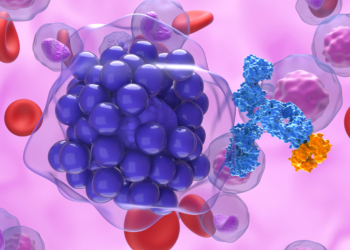 Bispecifics Before CAR-T May Be Best-Bet Sequence for Large B-Cell Lymphoma