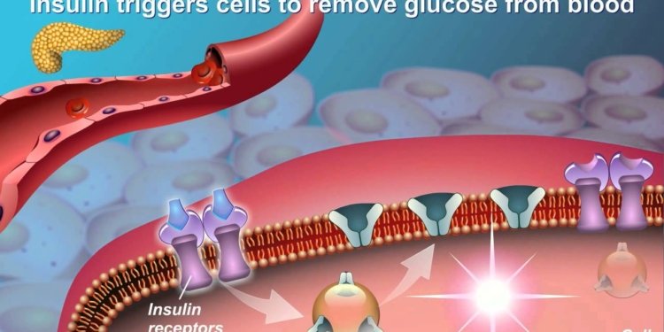 Understanding Type 2 Diabetes