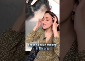 hair thinning solution