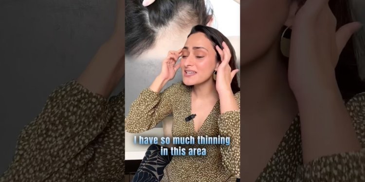 hair thinning solution