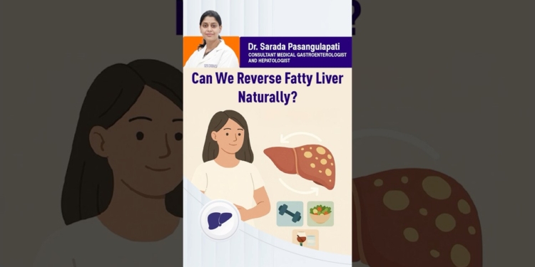 fatty liver treatment