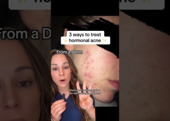 hormonal acne