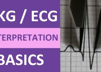 ECG basics