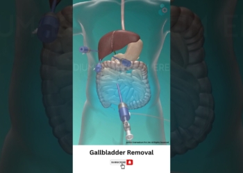 gallbladder health