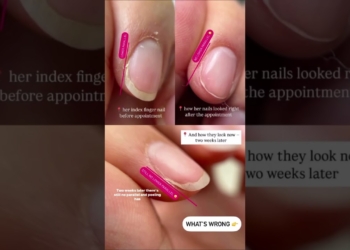 nail health