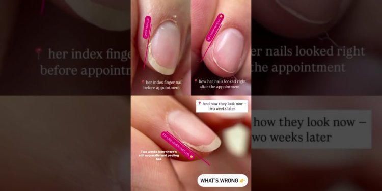 nail health