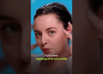 dandruff solution