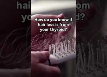 thyroid and hair fall