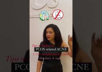 PCOS acne cure