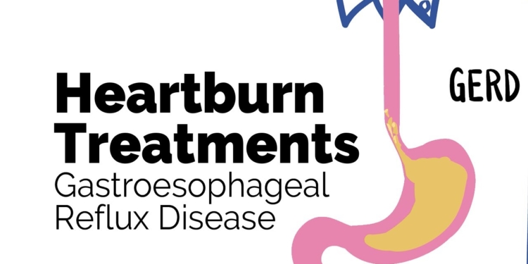 GERD cure
