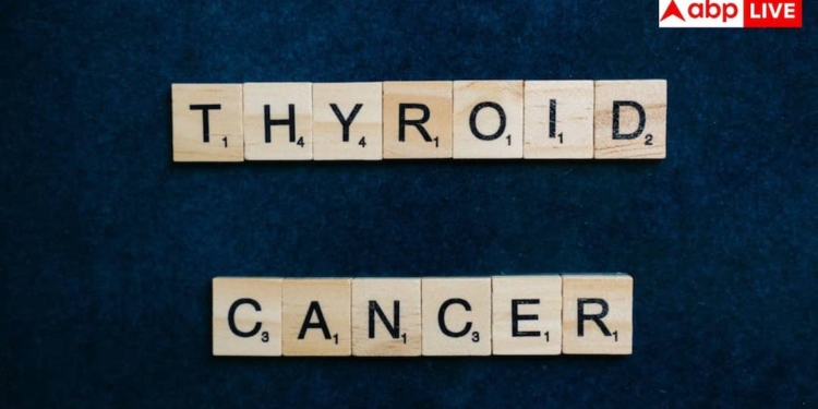 महिलाओं में थायरॉयड कैंसर का खतरा तीन गुना ज्यादा क्यों? जानिए इसके लक्षण, कारण और इलाज