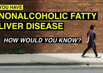 If You Have NAFLD, How Would You Know?
