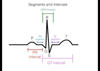 EKG/ECG Interpretation (Basic) : Easy and Simple!