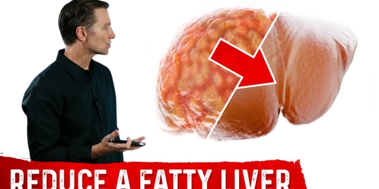 The Best Fatty Liver Exercise – Treatment of Fatty Liver – Dr.Berg