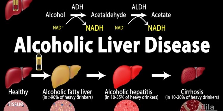 Alcoholic Liver Disease, Animation