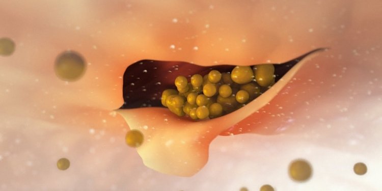 Dangers of High Blood Pressure