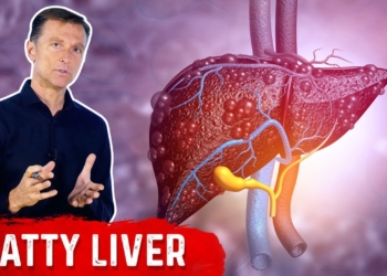 Why Does a Fatty Liver Have No Symptoms? – NAFLD (Non Alcoholic Fatty Liver Disease) by Dr.Berg